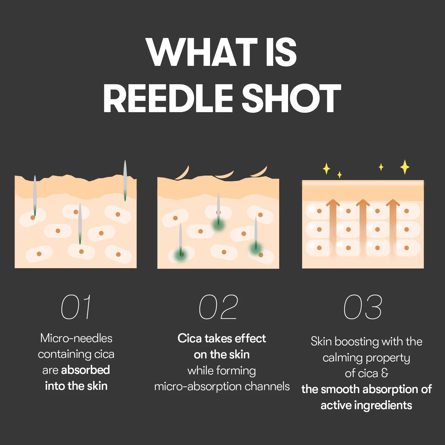 VT Reedle Shot - Image 3