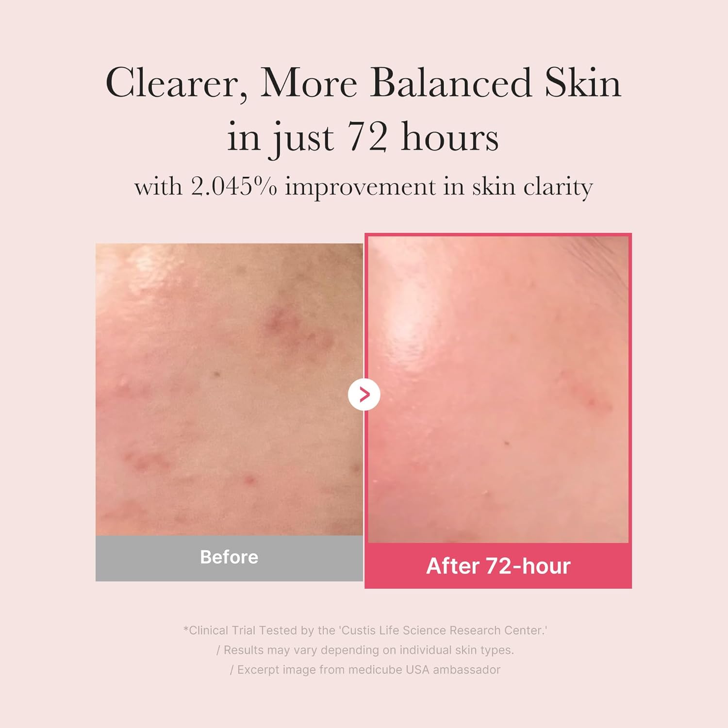 Medicube TXA Niacinamide Serum - Image 6