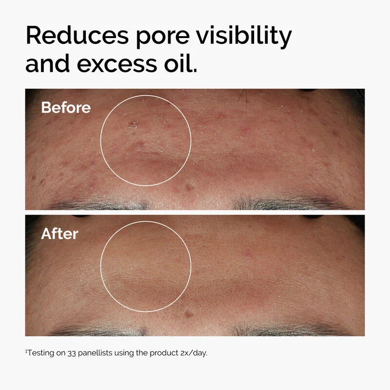 The Ordinary Niacinamide 10% + Zinc 1% (30ml) - Image 5
