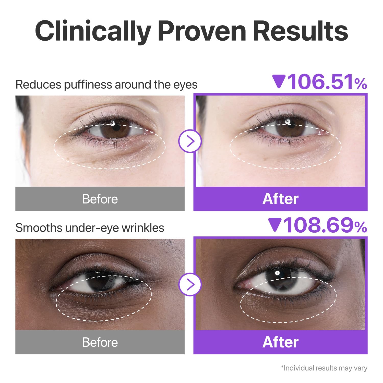 Numbuzin - No.9 NAD+ Collagen Under Eye Patches - Image 3