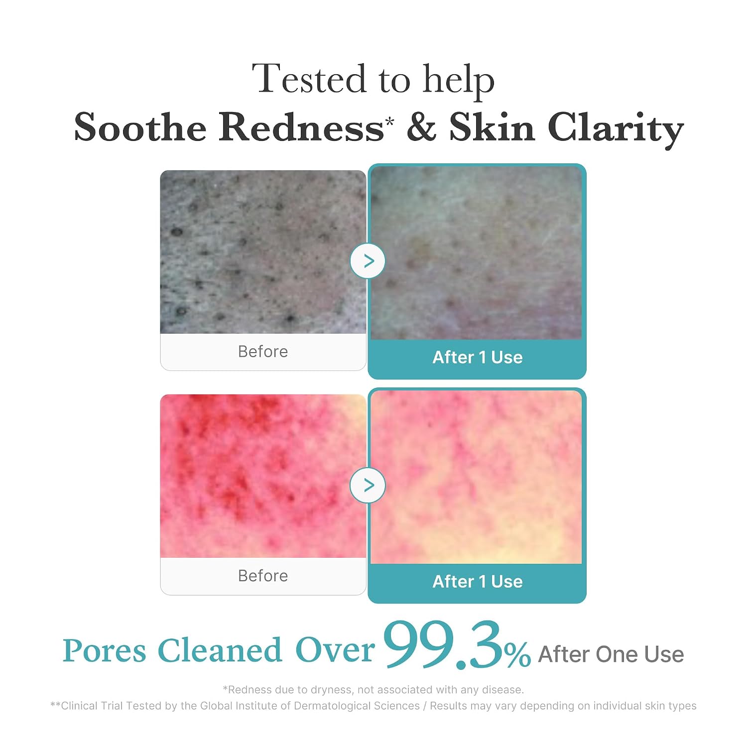Medicube Azelaic Acid Niacinamide Deep Clean Foam Cleanser - Image 4